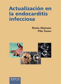 Books Frontpage Actualización en la endocarditis infecciosa