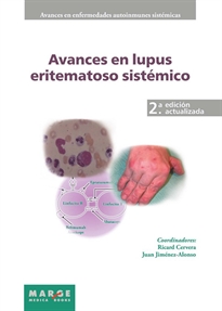 Books Frontpage Avances en lupus eritematoso sistémico
