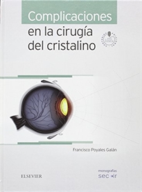 Books Frontpage Complicaciones en la cirugía del cristalino