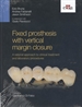 Front pageFixed prosthesis with vertical margin closure. A rational approach to clinical treatment and laboratory procedures