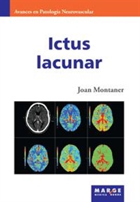 Books Frontpage Ictus lacunar