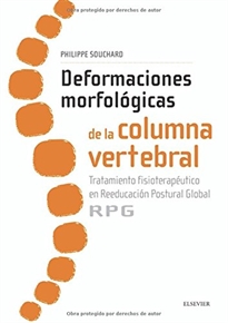 Books Frontpage Deformaciones morfológicas de la columna vertebral