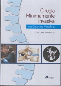 Books Frontpage Cirugía mínimamente invasiva de la columna vertebral