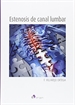 Front pageEstenosis del canal lumbar