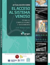 Books Frontpage Actualización sobre el acceso al sistema venoso