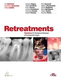 Books Frontpage Retreatment. Solutions for apical diseases of endodontic origin