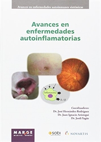 Books Frontpage Avances en enfermedades autoinflamatorias