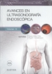 Front pageAvances en ultrasonografía endoscópica