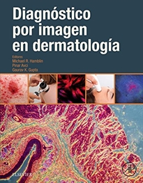 Books Frontpage Diagnóstico por imagen en dermatología