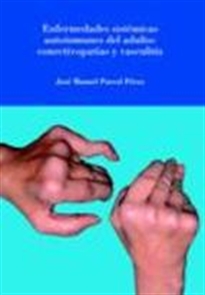 Books Frontpage Enfermedades sistémicas autoinmunes del adulto: conectivopatías y vasculitis.