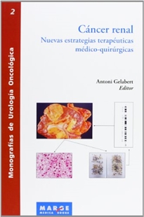 Books Frontpage Cáncer renal. Nuevas estrategias terapeuticas medico-quirurgicas