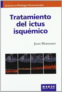 Books Frontpage Tratamiento del ictus isquémico