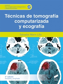 Books Frontpage Técnicas de tomografía computerizada (3.ª edición revisada y ampliada)