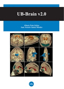 Books Frontpage UB-Brain v2.0 (Llibre+CD-Rom)