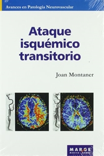Books Frontpage Ataque isquémico transitorio