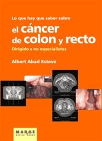 Books Frontpage Lo que hay que saber sobre el cáncer de colon y recto