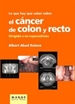 Front pageLo que hay que saber sobre el cáncer de colon y recto