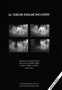 Books Frontpage El tercer molar incluido