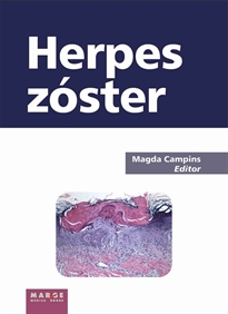 Books Frontpage Herpes zóster