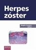 Front pageHerpes zóster