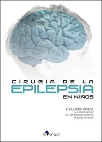 Books Frontpage Cirugía de la epilepsia en niños