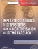 Front pageImplante quirúrgico de dispositivos para la monitorización del ritmo cardíaco