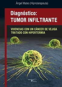 Books Frontpage Diagnóstico, tumor infiltrante