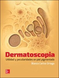 Books Frontpage Dermatoscopia Utilidad Y Peculiaridades En Piel Pigmentada