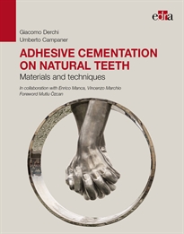 Books Frontpage Adhesive cementation on natural teeth. Materials and techniques