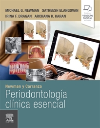 Books Frontpage Newman y Carranza. Periodontología clínica esencial