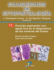 Books Frontpage Punción aspiración con aguja fina en el diagnóstico de los tumores de hueso