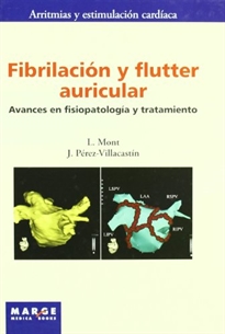 Books Frontpage Fibrilación y flutter auricular