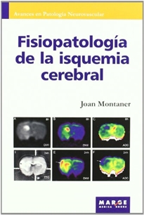 Books Frontpage Fisiopatología de la isquemia cerebral