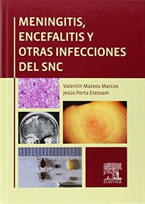 Books Frontpage Meningitis, encefalitis y otras infecciones del SNC