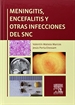 Front pageMeningitis, encefalitis y otras infecciones del SNC