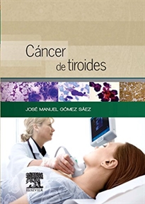 Books Frontpage Cáncer de tiroides