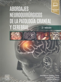 Books Frontpage Abordajes neuroquirúrgicos de la patología craneal y cerebral