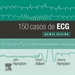 Portada del libro 150 casos de ECG