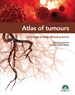 Front pageAtlas of tumours. Oncology in daily clinical practice