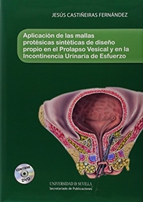 Books Frontpage Aplicación de las mallas protésicas sintéticas de diseño propio en el Prolapso Vesical y en la incontinencia Urinaria de Esfuerzo