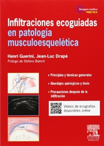 Books Frontpage Infiltraciones ecoguiadas en patología musculoesquelética