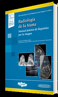 Books Frontpage Radiología de la Mama(+ebook)
