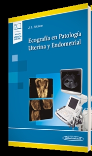 Books Frontpage Ecografía en Patología Uterina y Endometrial