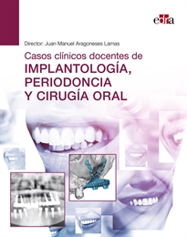 Books Frontpage Casos clínicos docentes de implantología, periodoncia y cirugía oral