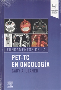 Books Frontpage Fundamentos de la PET-TC en oncología