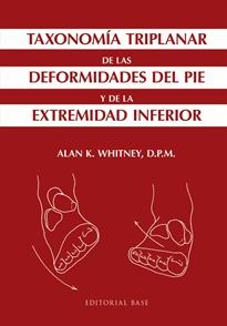 Books Frontpage Taxonomía triplanar de las deformidades del pie y de la extremidad inferior