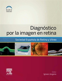 Books Frontpage Diagnóstico por la imagen en retina