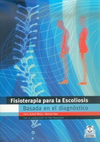 Books Frontpage Fisioterapia para la escoliosis basada en el diagnóstico