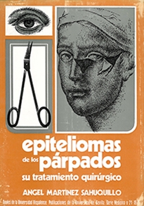 Books Frontpage Epiteliomas de los párpados, su tratamiento quirúrgico