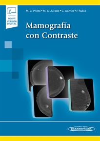 Books Frontpage Mamografía con Contraste (+ebook)